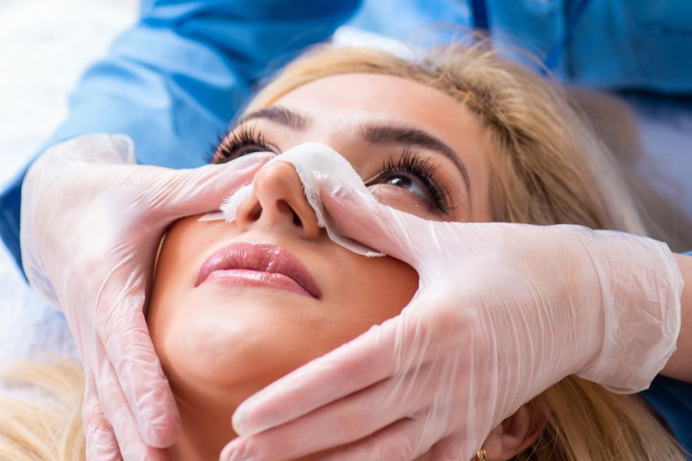 Rhinoplasty