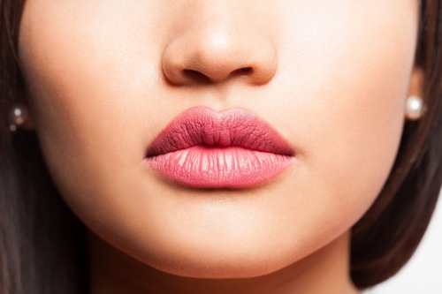 Lip Lift