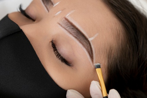 Eyebrow Transplantation